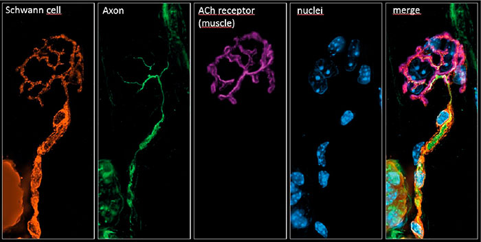 Neuromuscular junction in a mouse gastrocnemic muscle