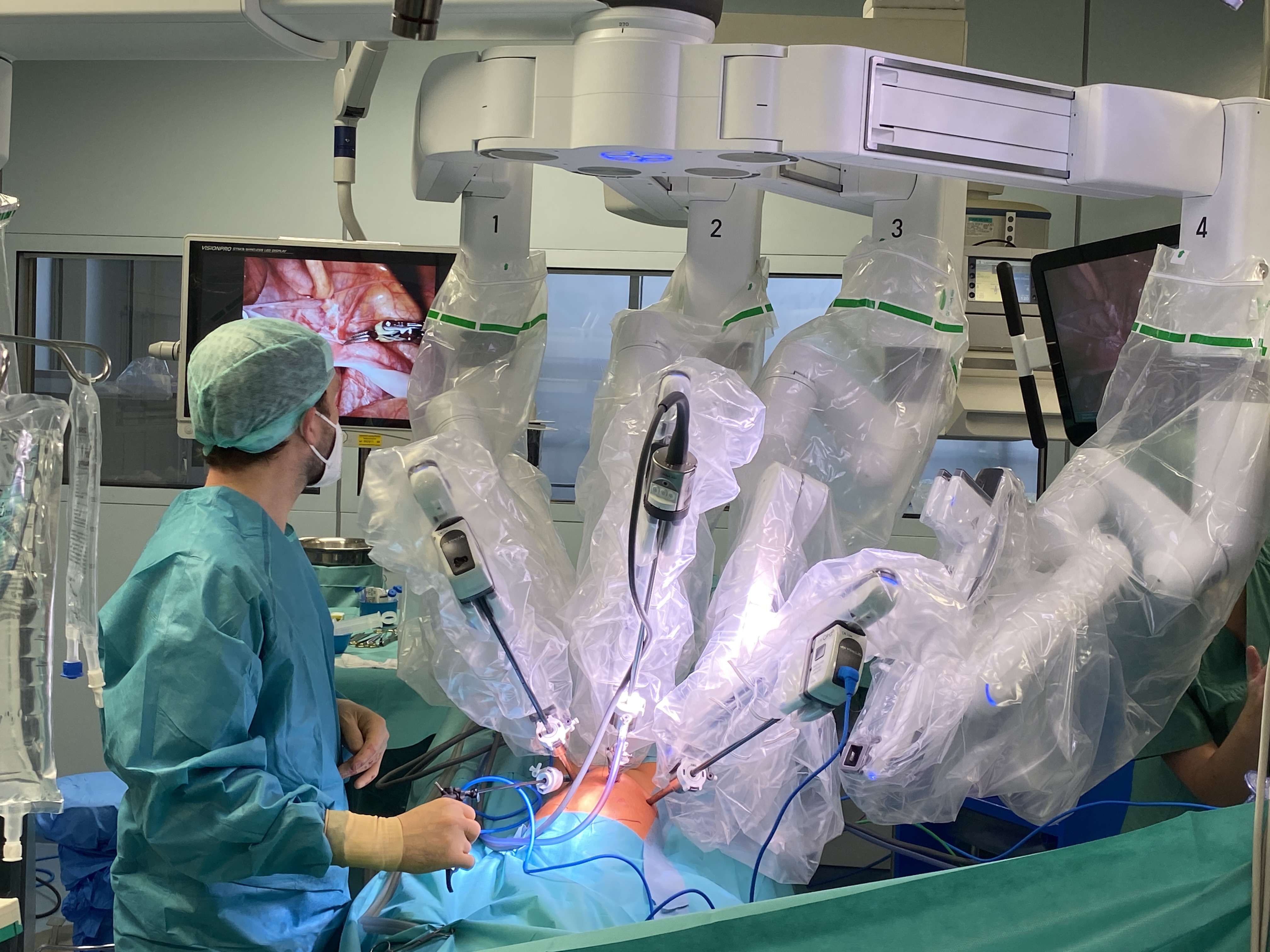 Robotische Chirurgie Kinderchirurgie uniklinikum leipzig