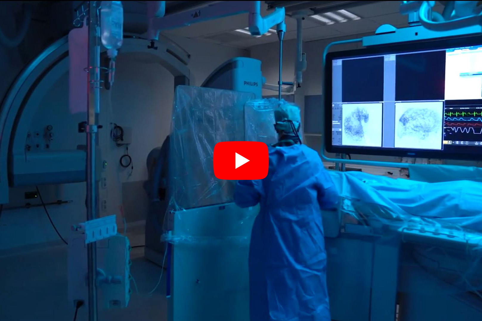 Patientenvideos der Neuroradiologie