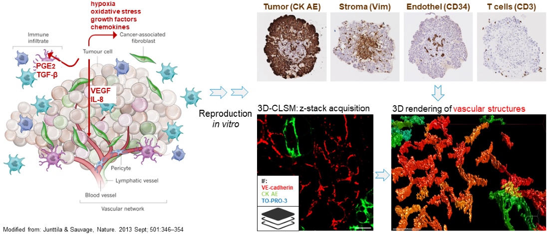 Rekonstruierte Hb-Tumororganoide.jpg