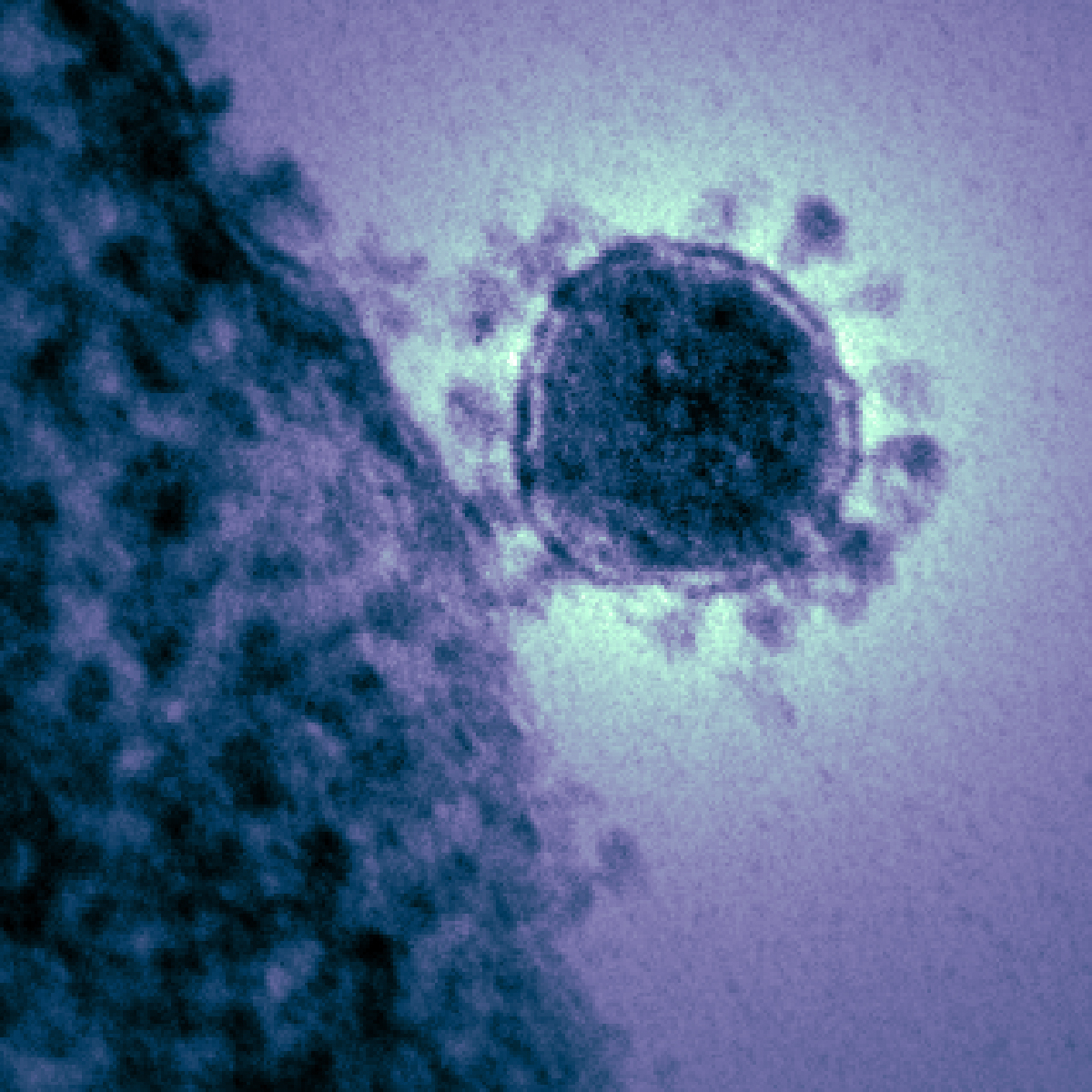 Nachweis von SARS-CoV-2 Viren