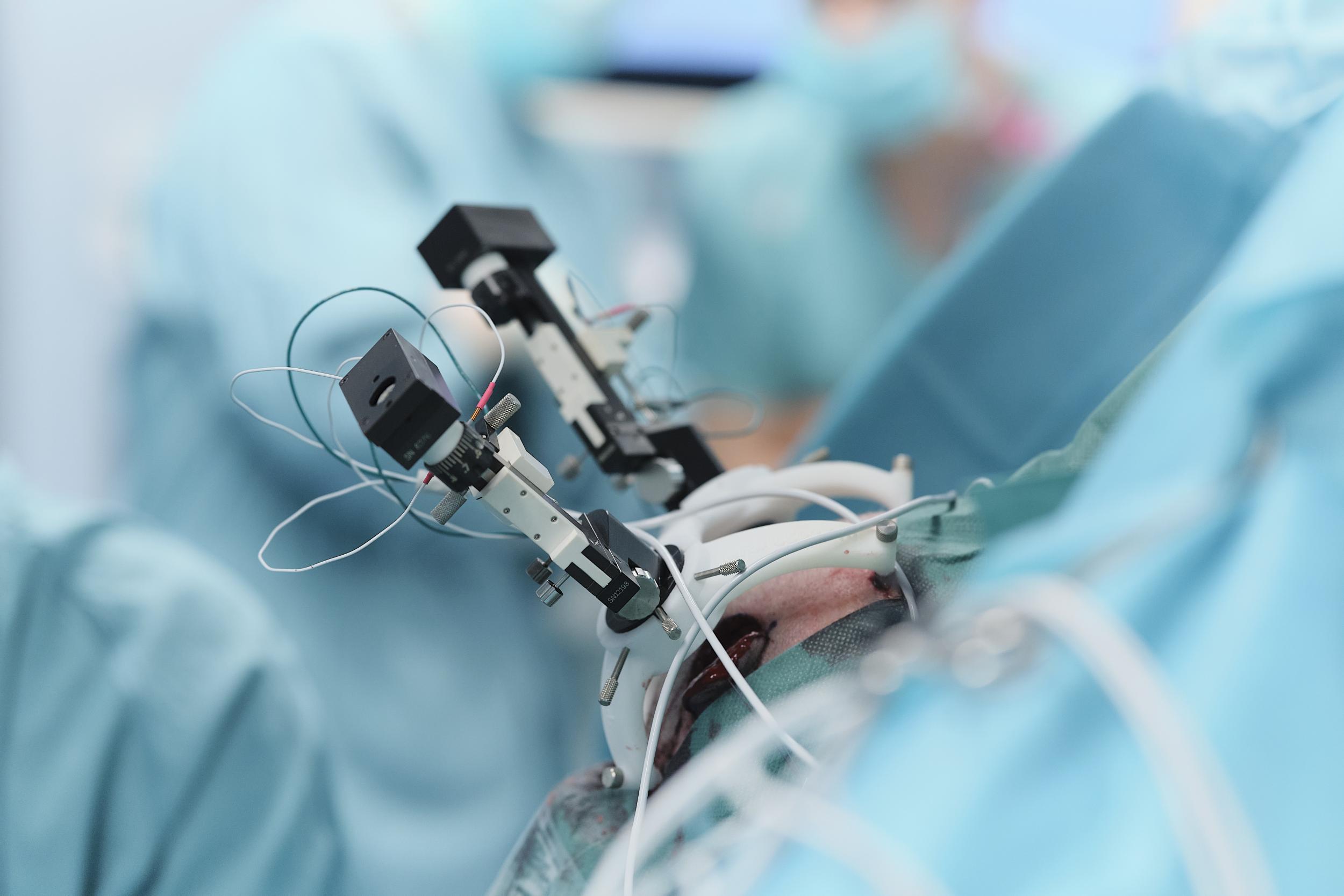 Mithilfe eines 3D-gedruckten Stereotaxie-Rahmens können Elektroden zur Hirnstimulation hochpräzise im Gehirn platziert werden.