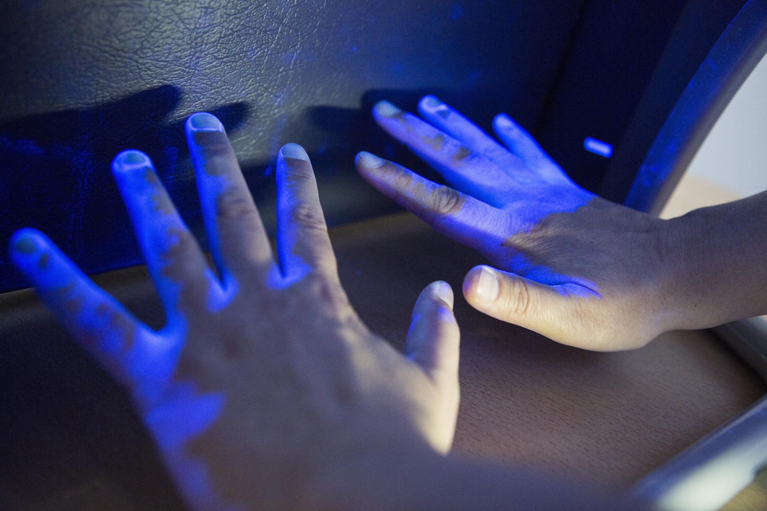 Unter ultraviolettem Licht wird mithilfe eines fluoreszierenden Kontrastmittels deutlich, welche Stellen bei der Händehygiene häufig vergessen werden.