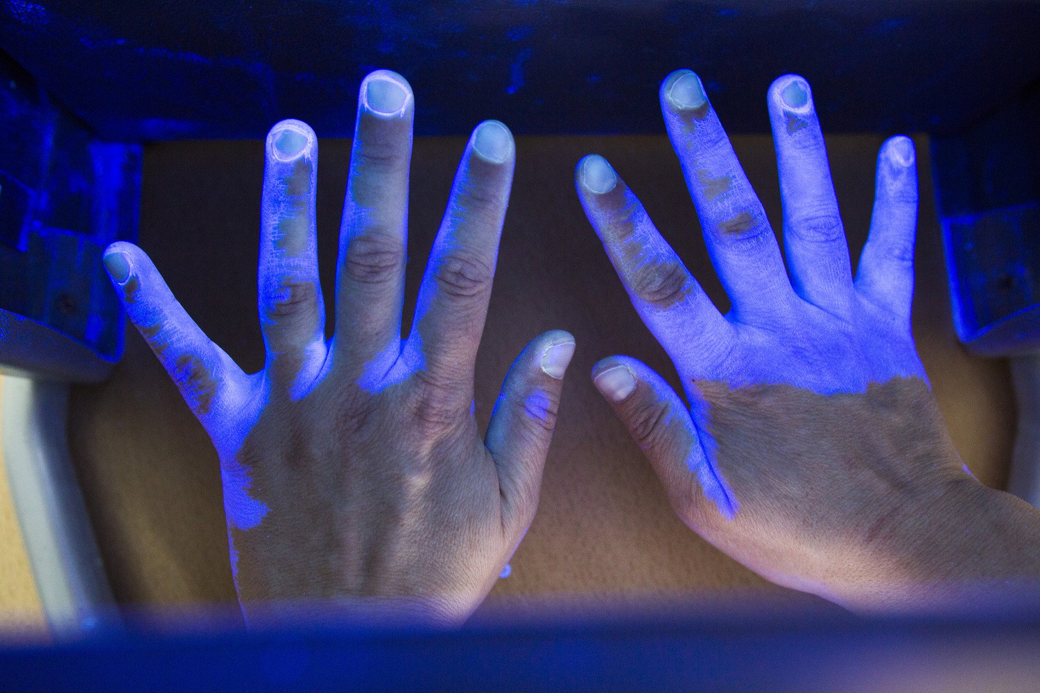 Ein Paar Hände unter UV-Licht: Beim Aktionstag am 5. Mai können Patienten und UKL-Mitarbeiter ihre "Werkzeuge" unter diesem speziellen Licht prüfen lassen.