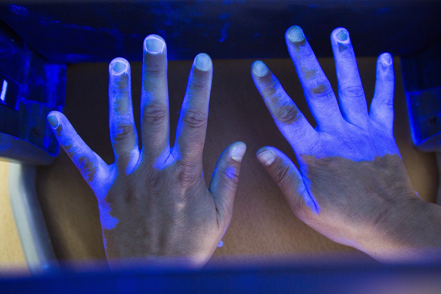 Ein Thema der Leipziger Krankenhaushygienetage - Desinfektion,.hier am Beispiel einer Prüfung der Hände mittels UV-Licht.