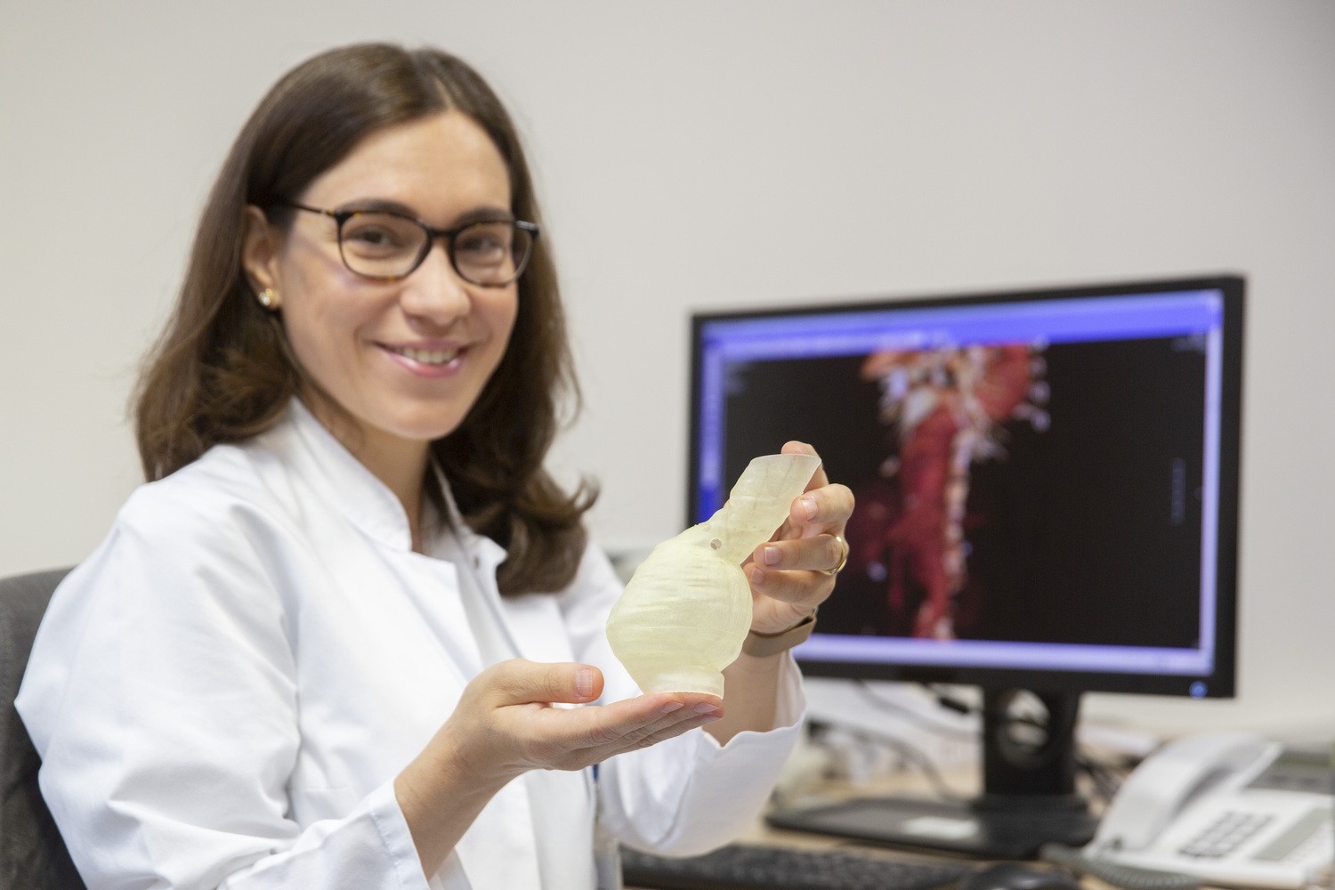Dr. Daniela Branzan, Gefäßchirurgin am Universitätsklinikum Leipzig, mit einer Prothese aus dem 3D-Drucker, die bei einem Aortenaneurysma – ganz individuell angepasst – eingesetzt werden kann.