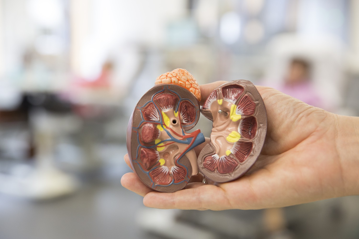 Ein aufgeschnittenes Modell einer Niere gewährt einen Blick ins Innere des Organs. Das Patientenseminar am 30. November richtet sich vor allem an diejenigen, die sich mit Fragen einer Transplantation befassen müssen.