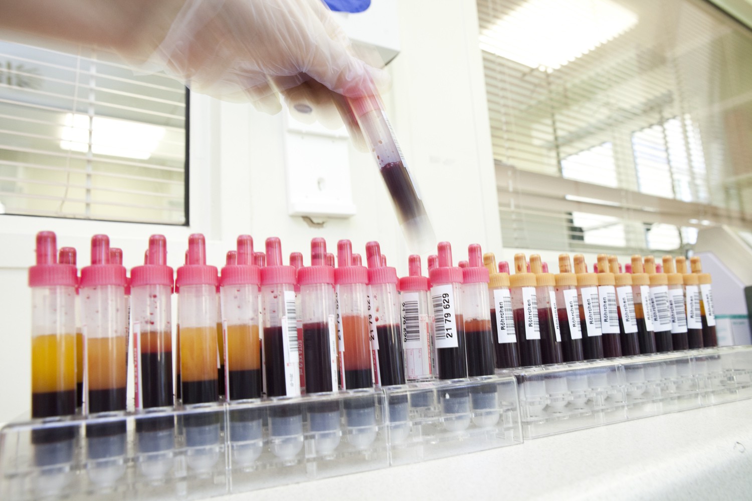 Bis 10. Juli können Blutspender bei der UKL-Blutbank im Rahmen ihrer Spende eine Corona-Antikörpertestung durchführen lassen.