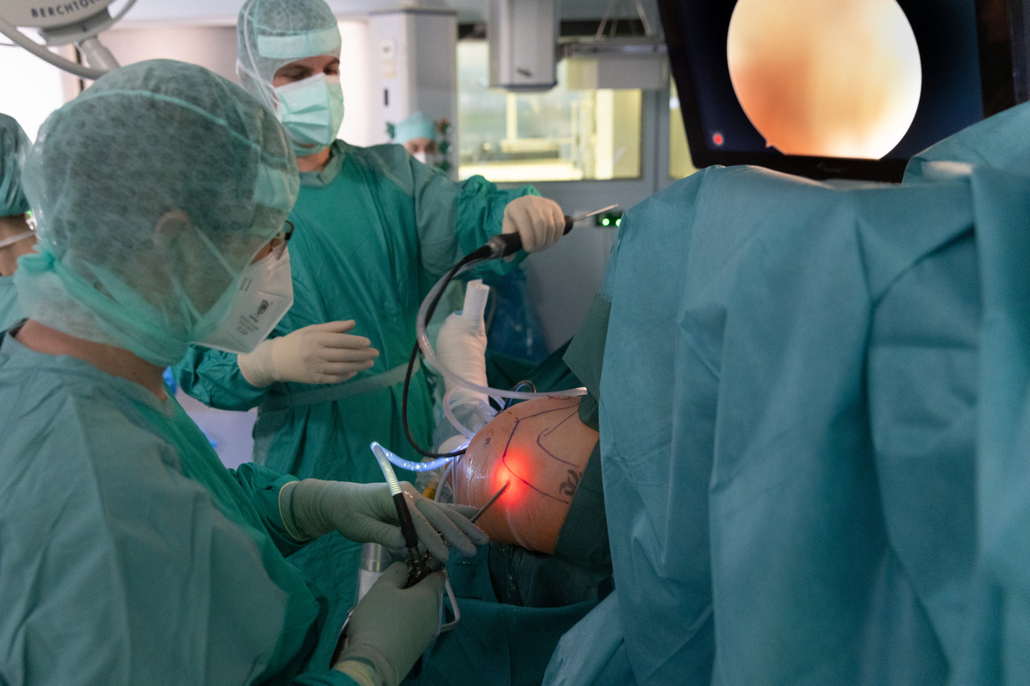 PD Dr. Jan Theopold (li.) bei einem arthroskopischen Eingriff an der Schulter: Das stabförmige Instrument erlaubt einen Blick ins Innere des Gelenks.