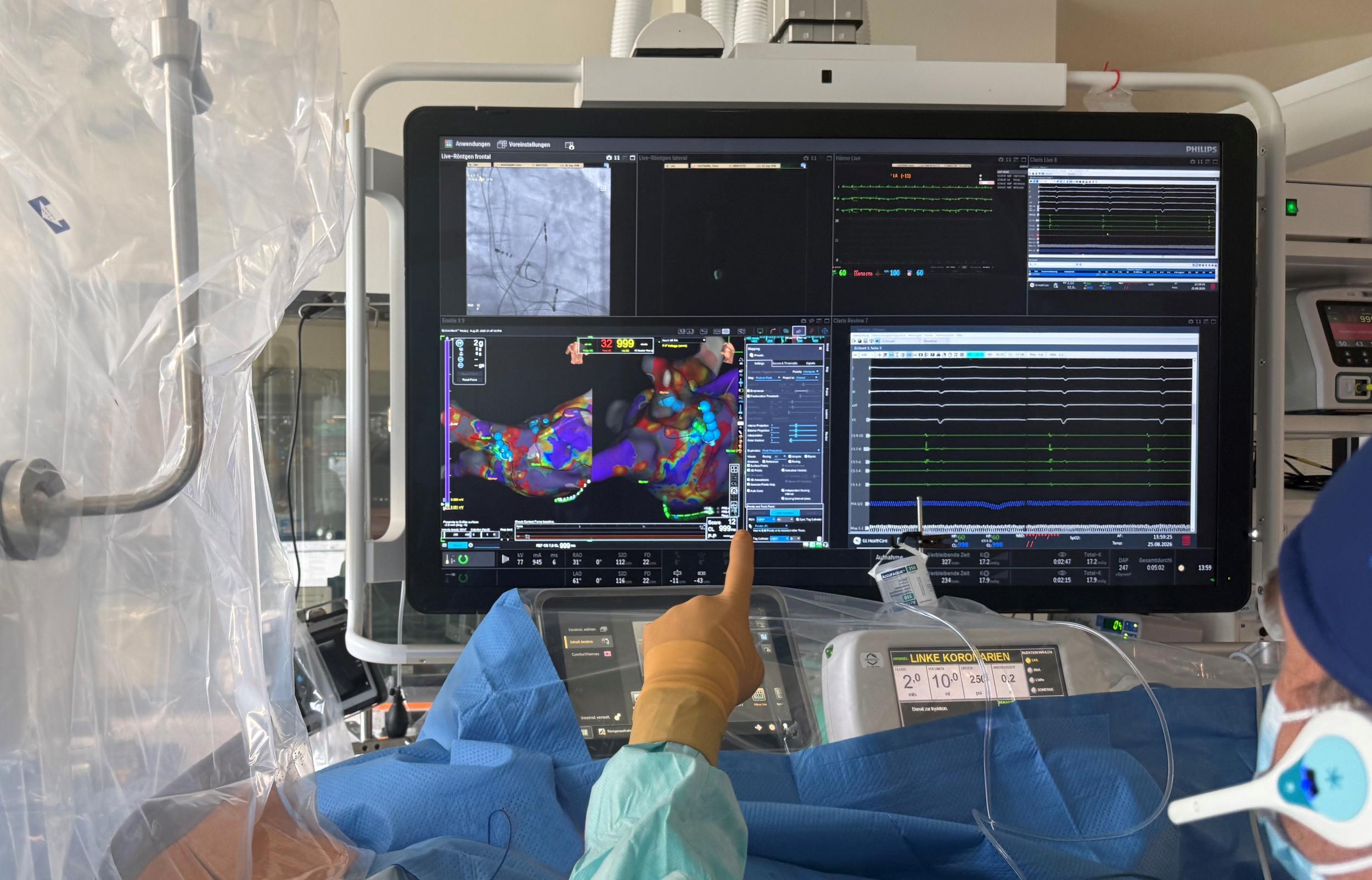 Katheterablation im Herzkatheterlabor des Universitätsklinikums Leipzig.