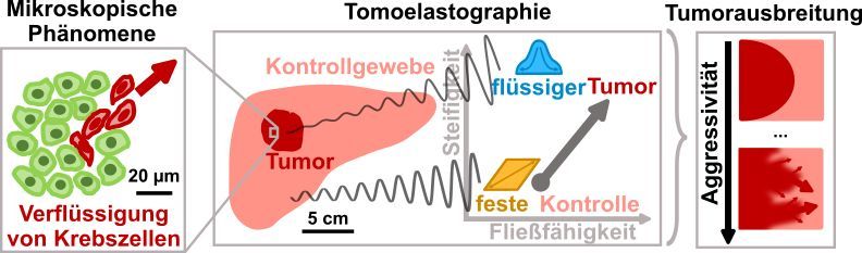 Tumor-assoziiert mikroskopische Effekte wie die Verflüssigung oder erhöhte Fließfähigkeit  von Krebszellen haben Einfluss auf die makroskopischen mechanischen Eigenschaften des Tumors. Letztere lassen sich direkt im Körper mit Tomoelastographie messen.