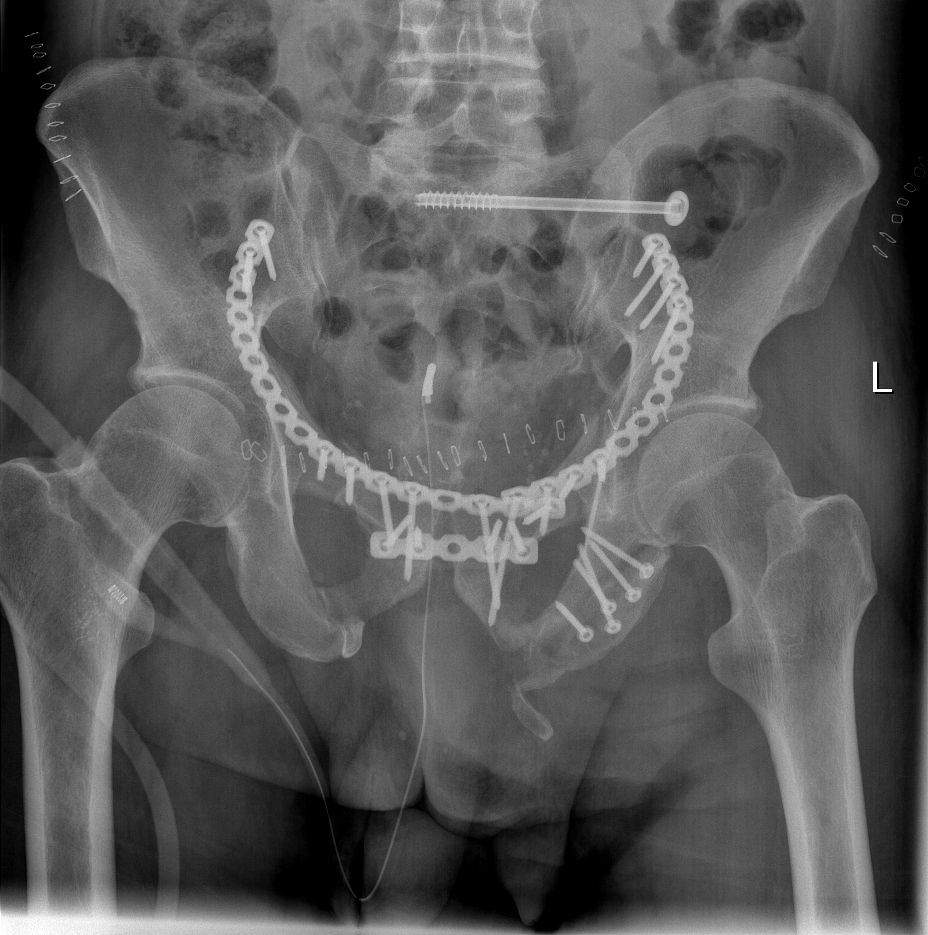 11.03. - 13.03.2026 <br> 3. Becken- und Hüftzugangskurs