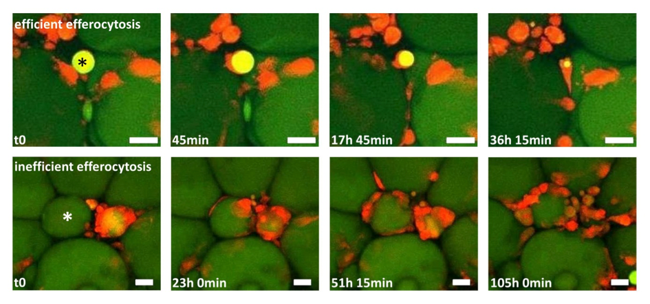 Standbilder aus zwei Zeitrafferfilmen zum Abräumverhalten von Makrophagen im Fettgewebe