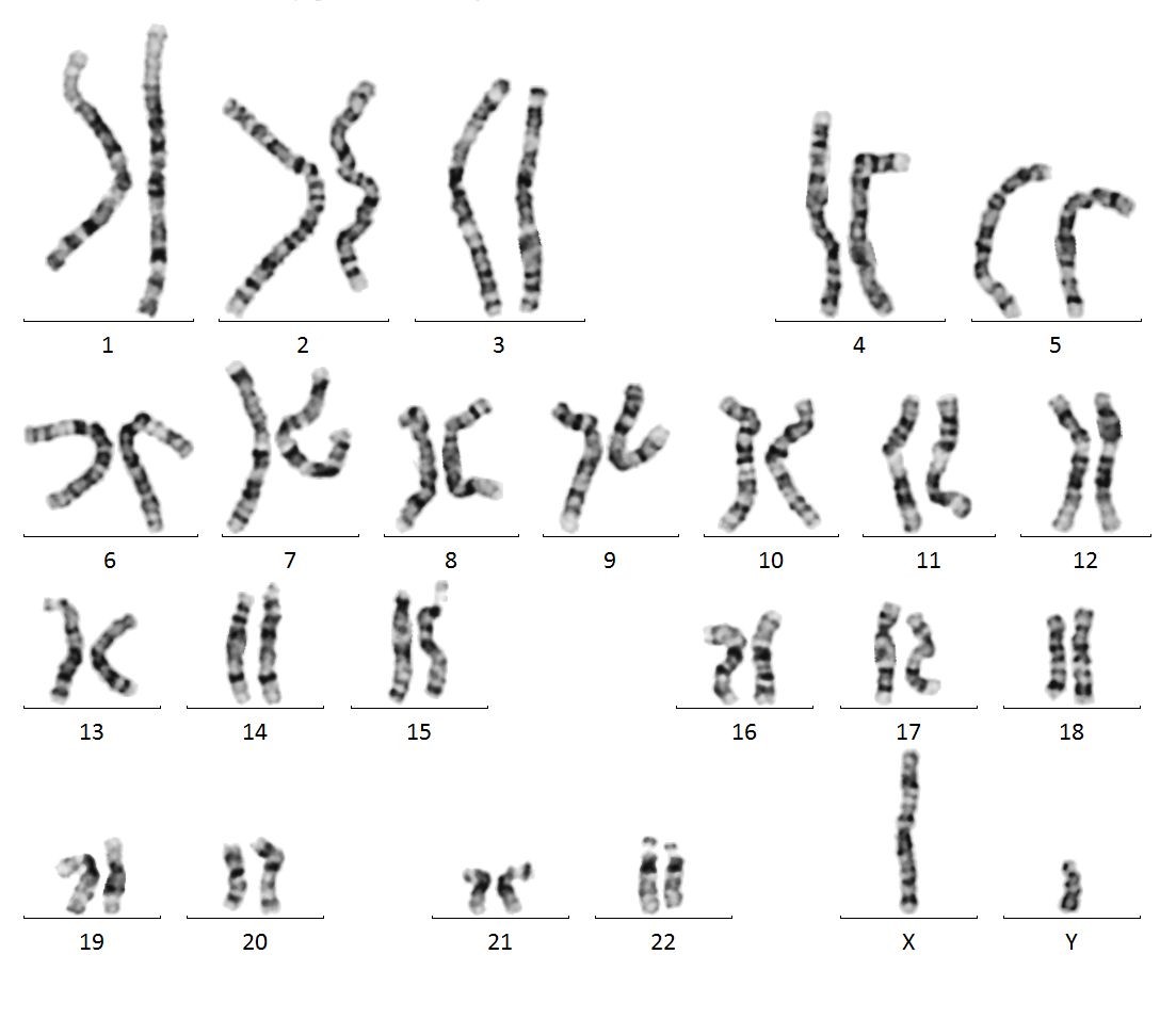 Unauffälliger männlicher Karyotyp mit 46,XY
